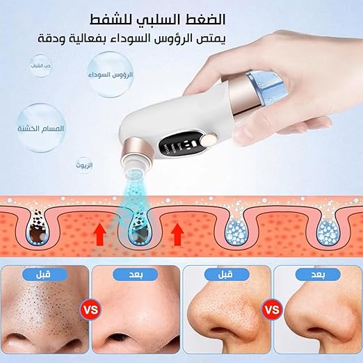 جهاز ازالة الرؤوس السوداء بالمياه 6
