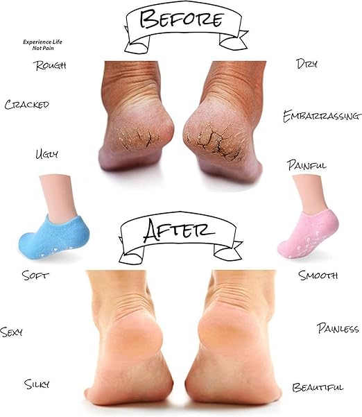 شراب السيليكون طبى لترطيب ونعومة القدمين - 3